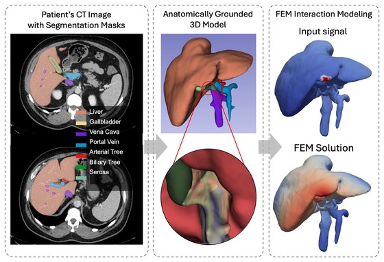 From a patient's segmented CT to an anatomically grounded 3D liver model and FEM interaction modeling